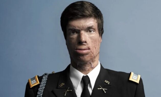 Silverman samuel